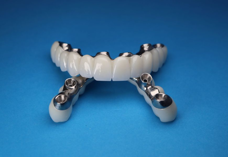 Orthopaedic Knee Implants: Proven Data Submission Process